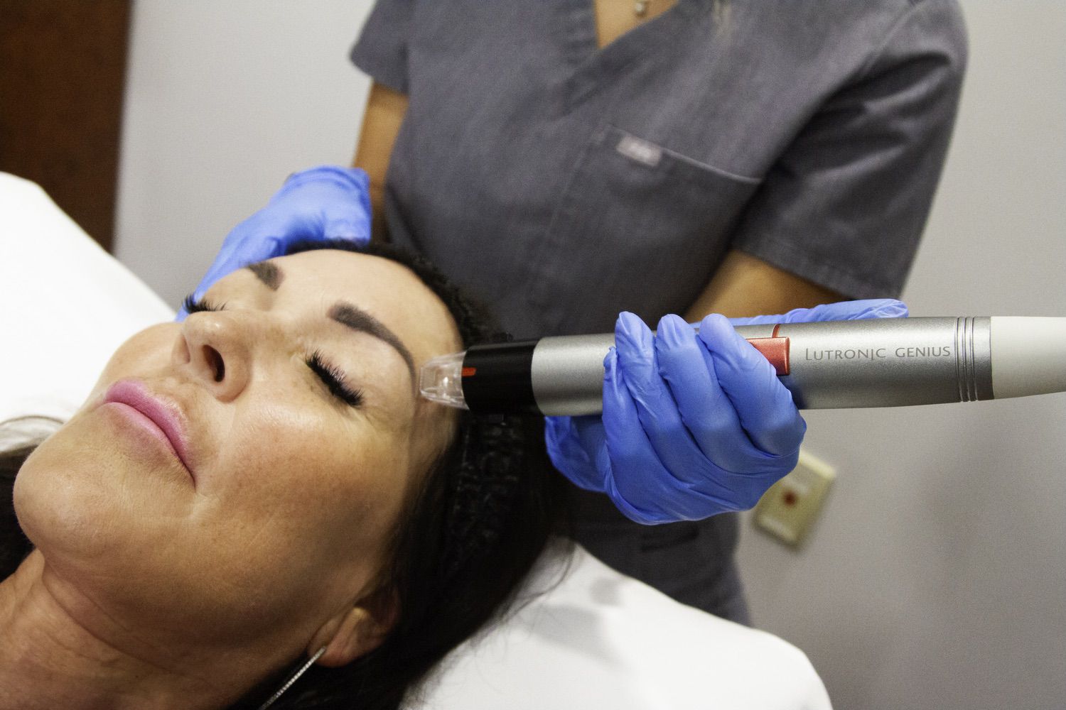 Microneedling rf